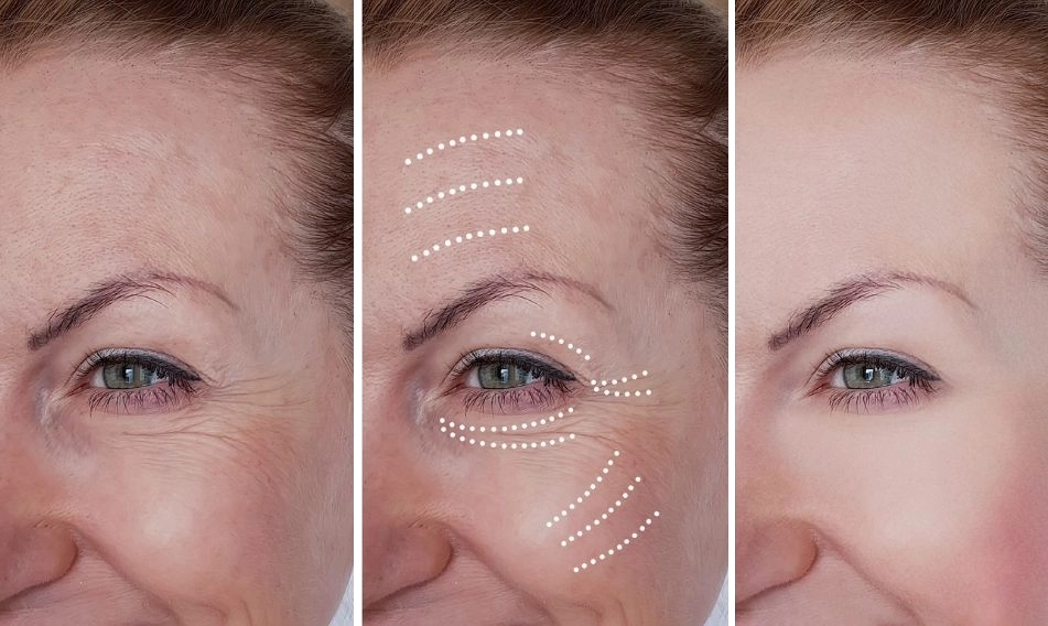Resultados Transforma tu rostro y realza tu belleza natural
